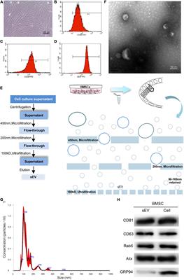 BMSC-Derived Small Extracellular Vesicles Induce Cartilage Reconstruction of Temporomandibular Joint Osteoarthritis via Autotaxin–YAP Signaling Axis